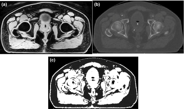 Figure 2