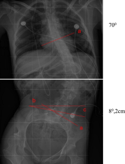 Fig. 2