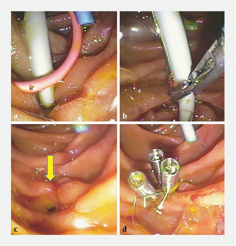 Fig. 1