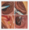 Fig. 2