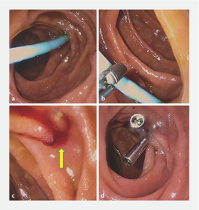 Fig. 2