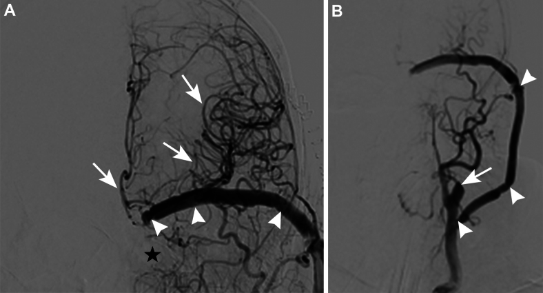 FIG. 4.