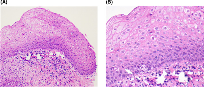 FIGURE 3