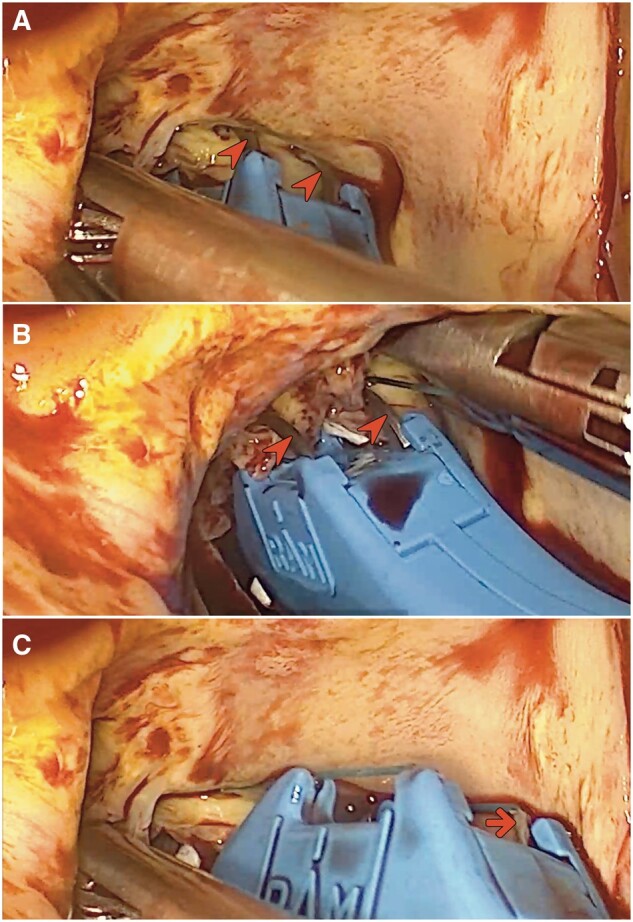 Figure 3: