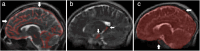 Fig. 13