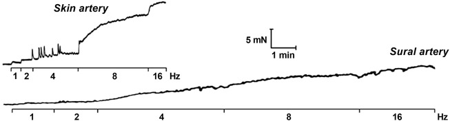 FIGURE 12