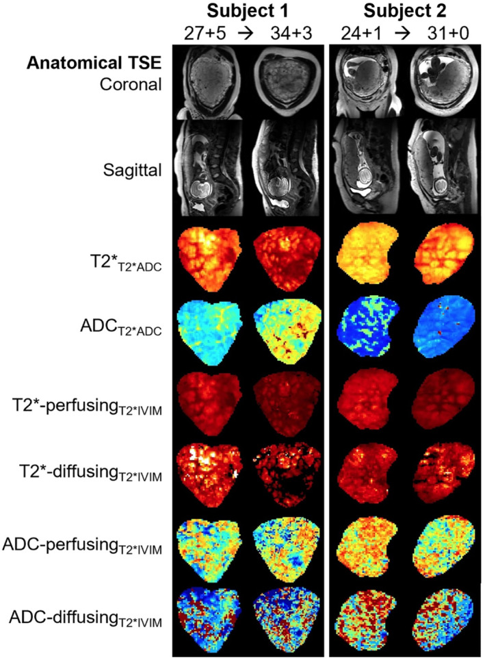 MRM-29665-FIG-0002-c