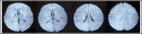 Fig.2