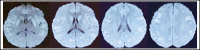 Fig.1