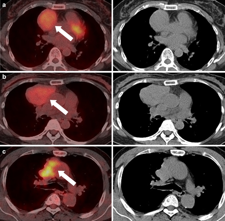 Fig. 3