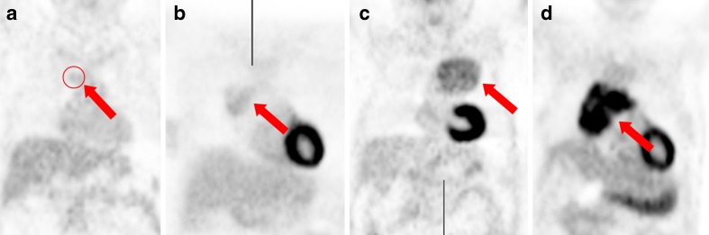 Fig. 1