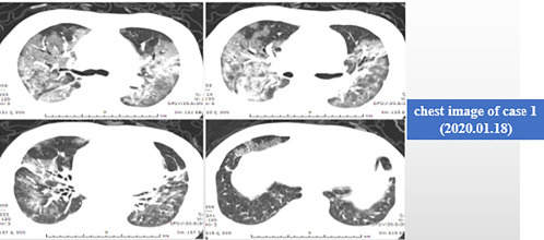 Fig. 5.4