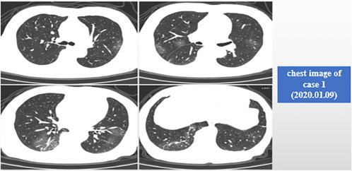 Fig. 5.1