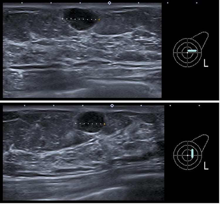 Fig 2 –