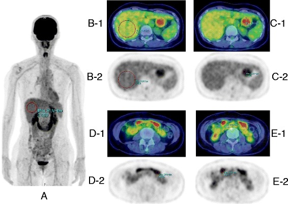 Fig. 1