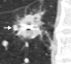 Figure 5b
