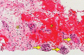 Figure 11e