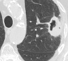 Figure 16a
