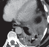 Figure 9d
