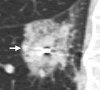 Figure 5c