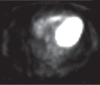 Figure 18b