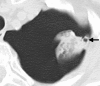 Figure 10b