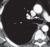 Figure 17a