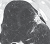 Figure 11b
