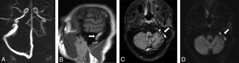 Fig 2.