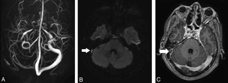 Fig 4.