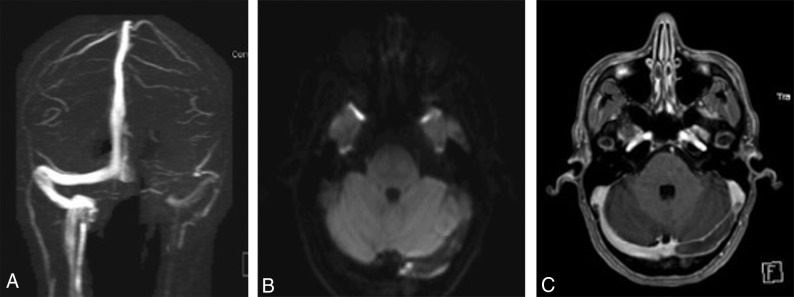 Fig 3.