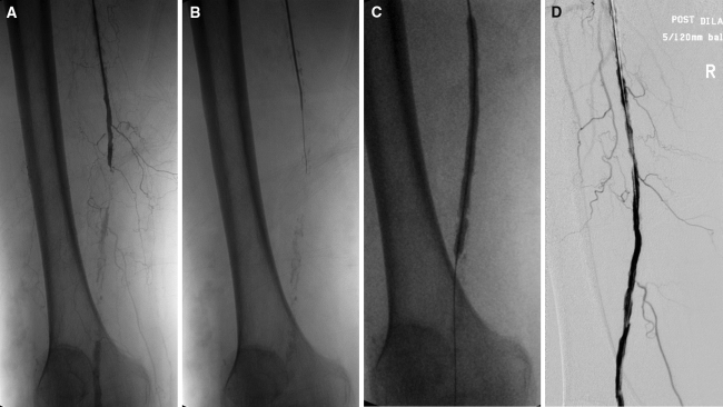 Fig. 1