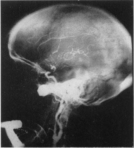 Fig. 4(b)