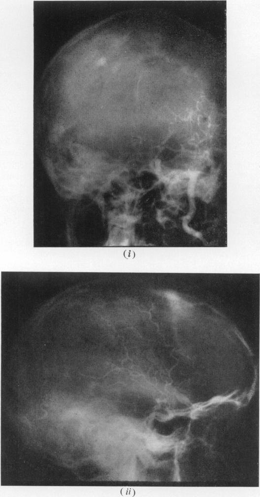 Fig. 5(a)