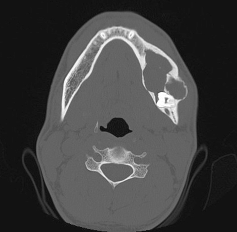 Fig. 1