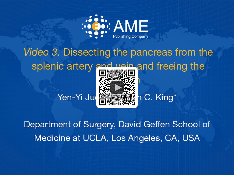 Robotic Assisted Spleen Preserving Distal Pancreatectomy A Technical