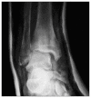 Fig. 2