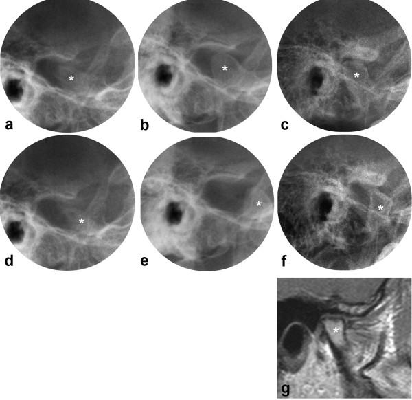 Figure 6