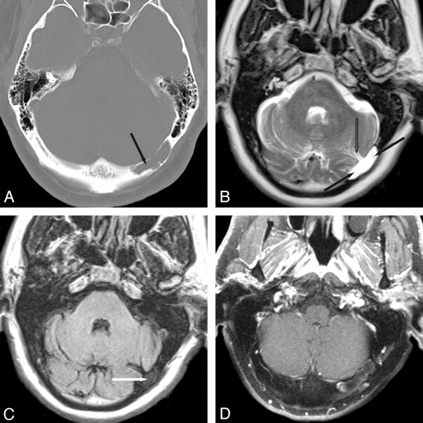 Fig 1.