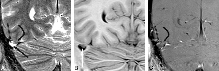 Fig 3.