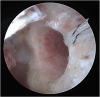 Fig 14