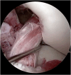 Fig 23
