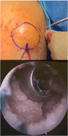 Fig 21