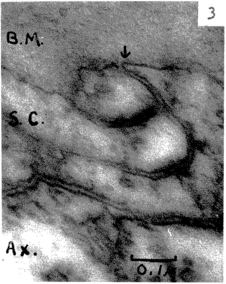 graphic file with name pnas00736-0095-c.jpg