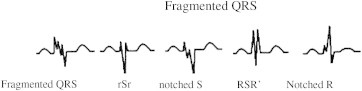 Fig. 1