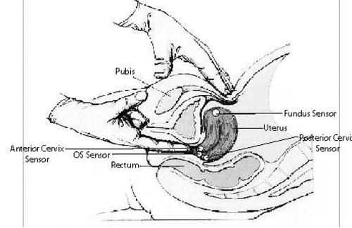 Figure 3 