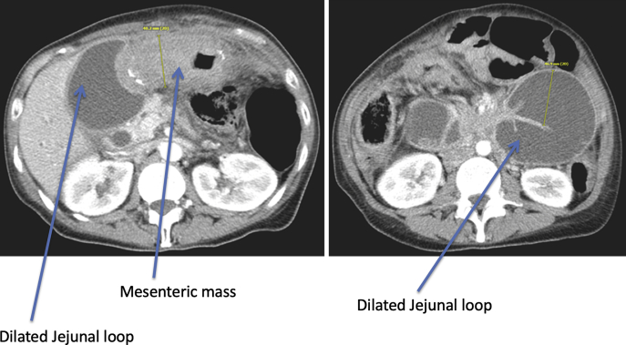 Figure 2