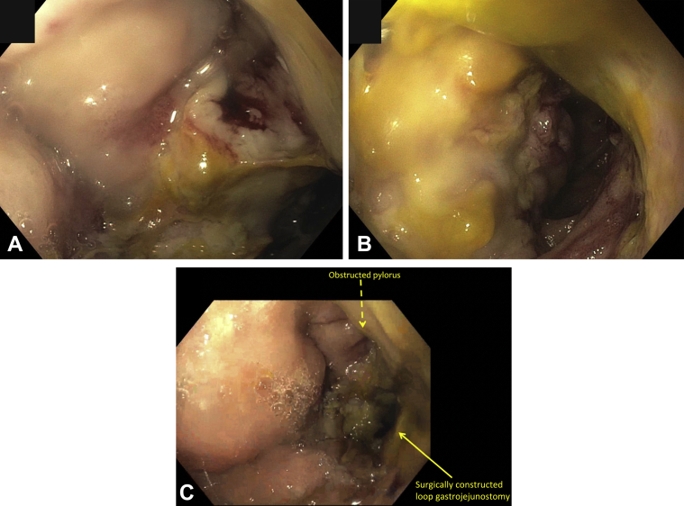 Figure 4