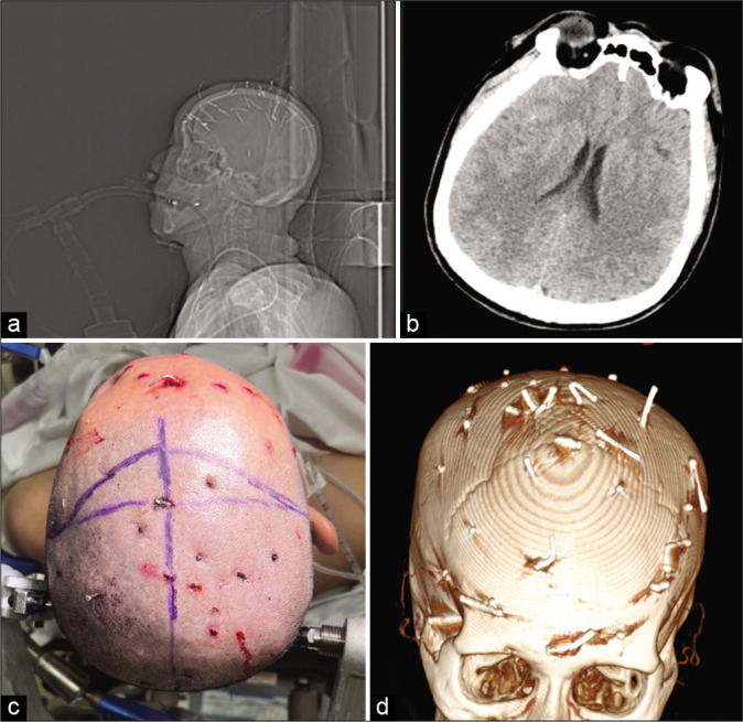 Figure 1: