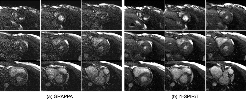 FIG 5.